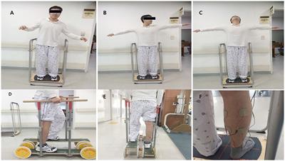 Multi-Sensorimotor Training Improves Proprioception and Balance in Subacute Stroke Patients: A Randomized Controlled Pilot Trial